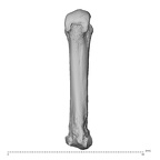 metacarpal third left