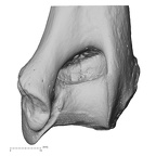 humerus right distal