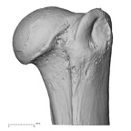 Upper limb