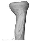 radius right proximal