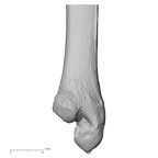 ulna right distal