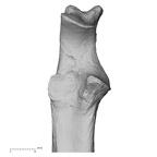 ulna right proximal