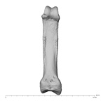 hand phalanx fifth proximal left