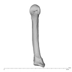 metacarpal fifth left