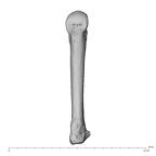 metacarpal fourth left
