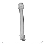metacarpal second left
