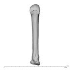 metacarpal third left