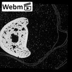 NH MER39 232 Piliocolobus preussi hand phalanx fifth proximal right ct stack movie