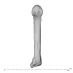 metacarpal fifth right