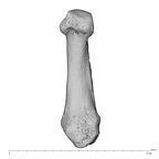 metacarpal first right