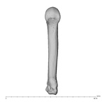 metacarpal fourth right