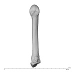 metacarpal second right