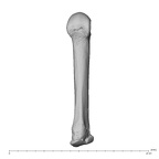 metacarpal third right