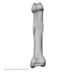 hand phalanx fifth proximal right
