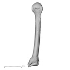 metacarpal fifth right