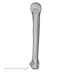metacarpal fourth right