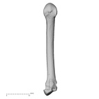 metacarpal second right