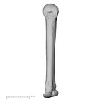 metacarpal third right