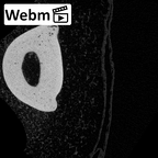 NH MER39 246 Piliocolobus preussi hand phalanx fifth proximal left ct stack movie