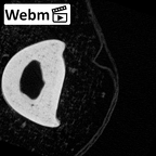 NH MER39 265 Piliocolobus preussi hand phalanx fifth proximal right ct stack movie