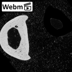 NH MER39 265 Piliocolobus preussi hand phalanx third proximal right ct stack movie