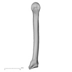 metacarpal fifth right
