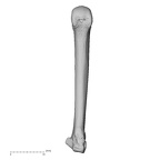 metacarpal fourth right