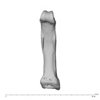 hand phalanx fifth proximal left