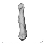 metacarpal first left