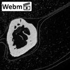 NH MER39 274 Piliocolobus preussi metacarpal first left ct stack movie