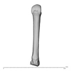 metacarpal third left