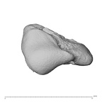 scaphoid os centrale left