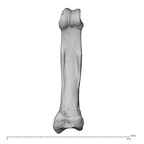 hand phalanx fifth proximal right