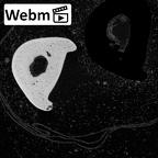 NH MER39 285 Piliocolobus preussi hand phalanx second proximal right ct stack movie