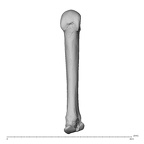 metacarpal third right