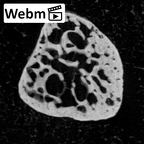 NH MER39 285 Piliocolobus preussi sesamoid hand ct stack movie