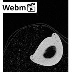 NH MER39 290 Piliocolobus preussi hand phalanx fifth proximal right ct stack movie