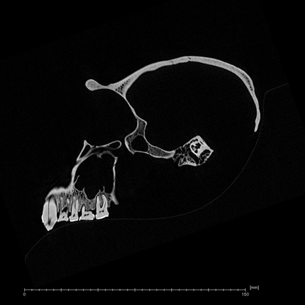 SMF-PA-PC-100 Pan troglodytes verus cranium ct slice