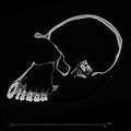 SMF-PA-PC-50 Pan troglodytes verus cranium ct slice