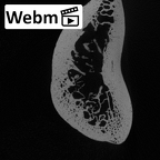 LVRB Neanderthal1 D322 09 Homo neanderthalensis humerus right distal ct stack movie