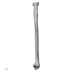LVRB Neanderthal1 D322 10 H. neanderthalensis radius right