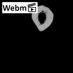 LVRB Neanderthal1 D322 10 Homo neanderthalensis radius right ct stack movie