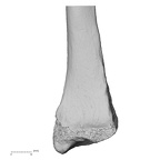 LVRB Neanderthal1 D322 10 Homo neanderthalensis radius right distal anterior