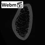 LVRB Neanderthal1 D322 10 Homo neanderthalensis radius right distal ct stack movie