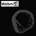 LVRB Neanderthal1 D322 10 Homo neanderthalensis radius right proximal ct stack movie