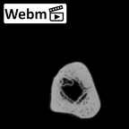 LVRB Neanderthal1 D322 11 Homo neanderthalensis ulna right ct stack movie