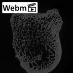 LVRB Neanderthal1 D322 11 Homo neanderthalensis ulna right proximal ct stack movie