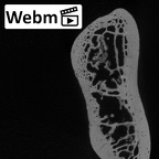 LVRB Neanderthal1 D322 12 Homo neanderthalensis humerus left distal ct stack movie