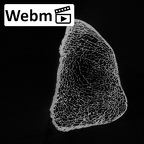 LVRB Neanderthal1 D322 16 Homo neanderthalensis femur right distal ct stack movie