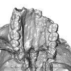 STEINHEIM SMNS-P-17230 SMNS-P-17230 Homo heidelbergensis cranium maxilla